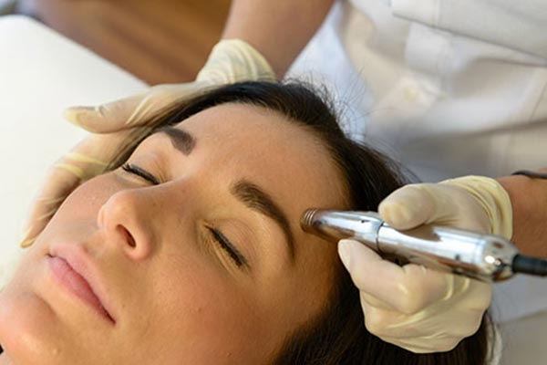 Microneedling